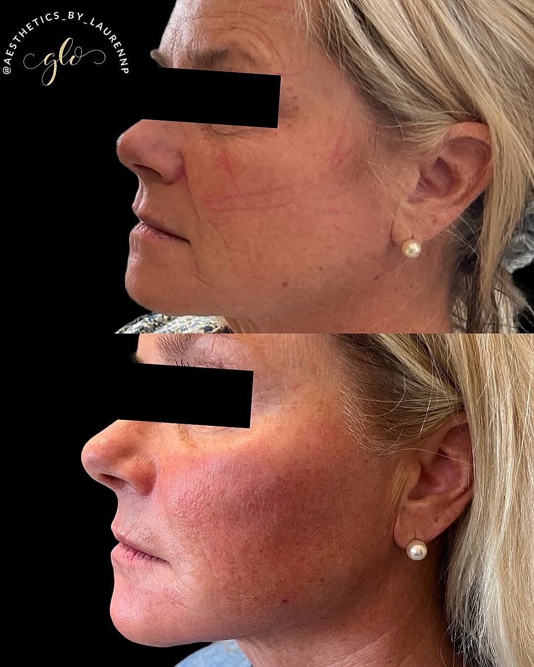 8 Point Sculpt Before & After