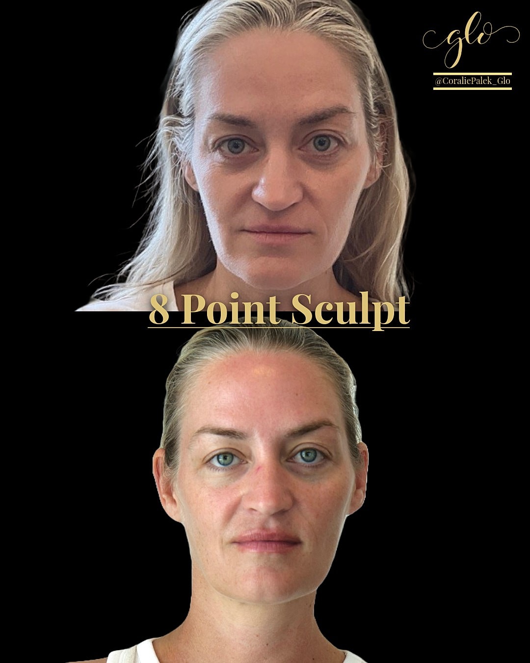 8 Point Sculpt Before & After