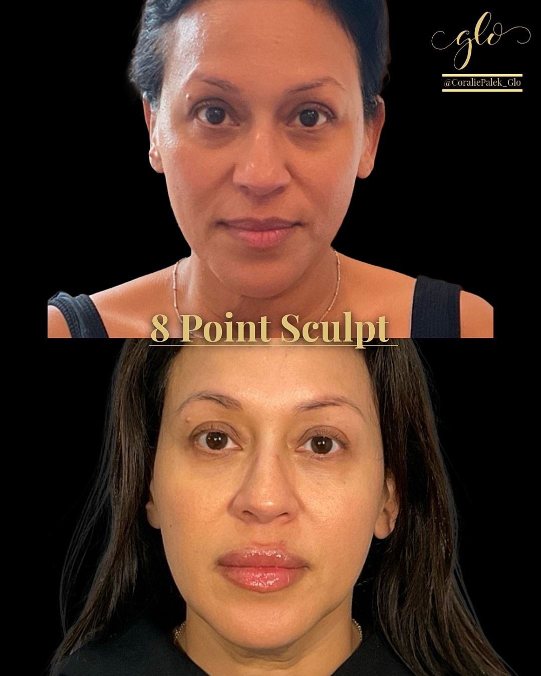 8 Point Sculpt Before & After