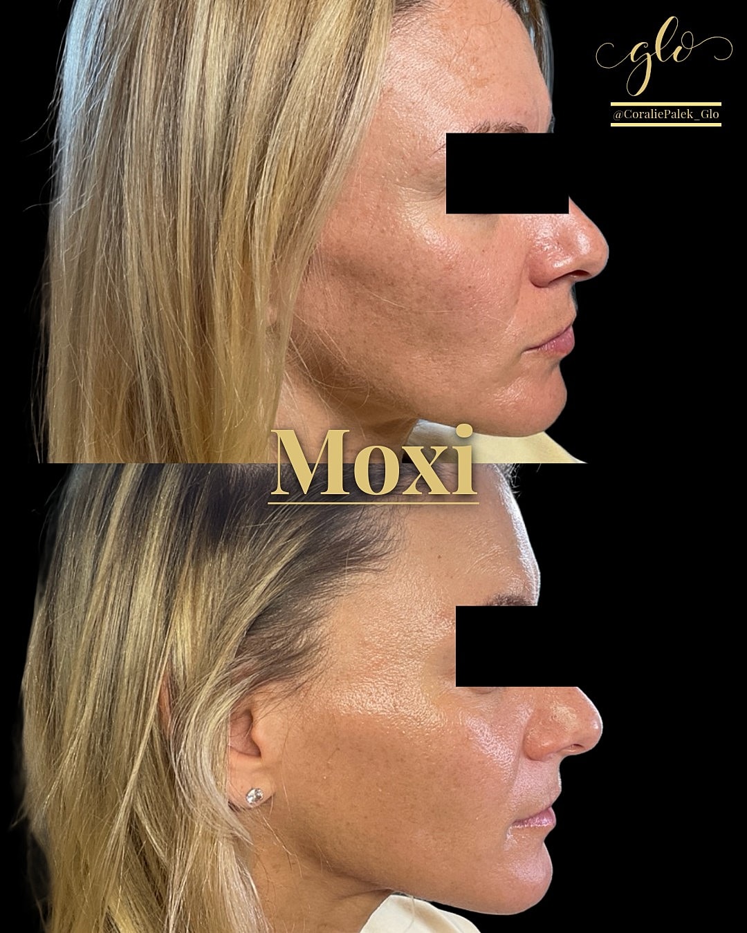 MOXI Gallery Before & After