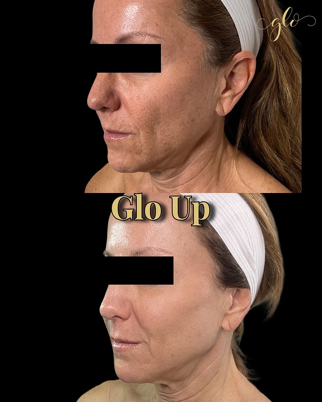 Glo Up Gallery Before & After