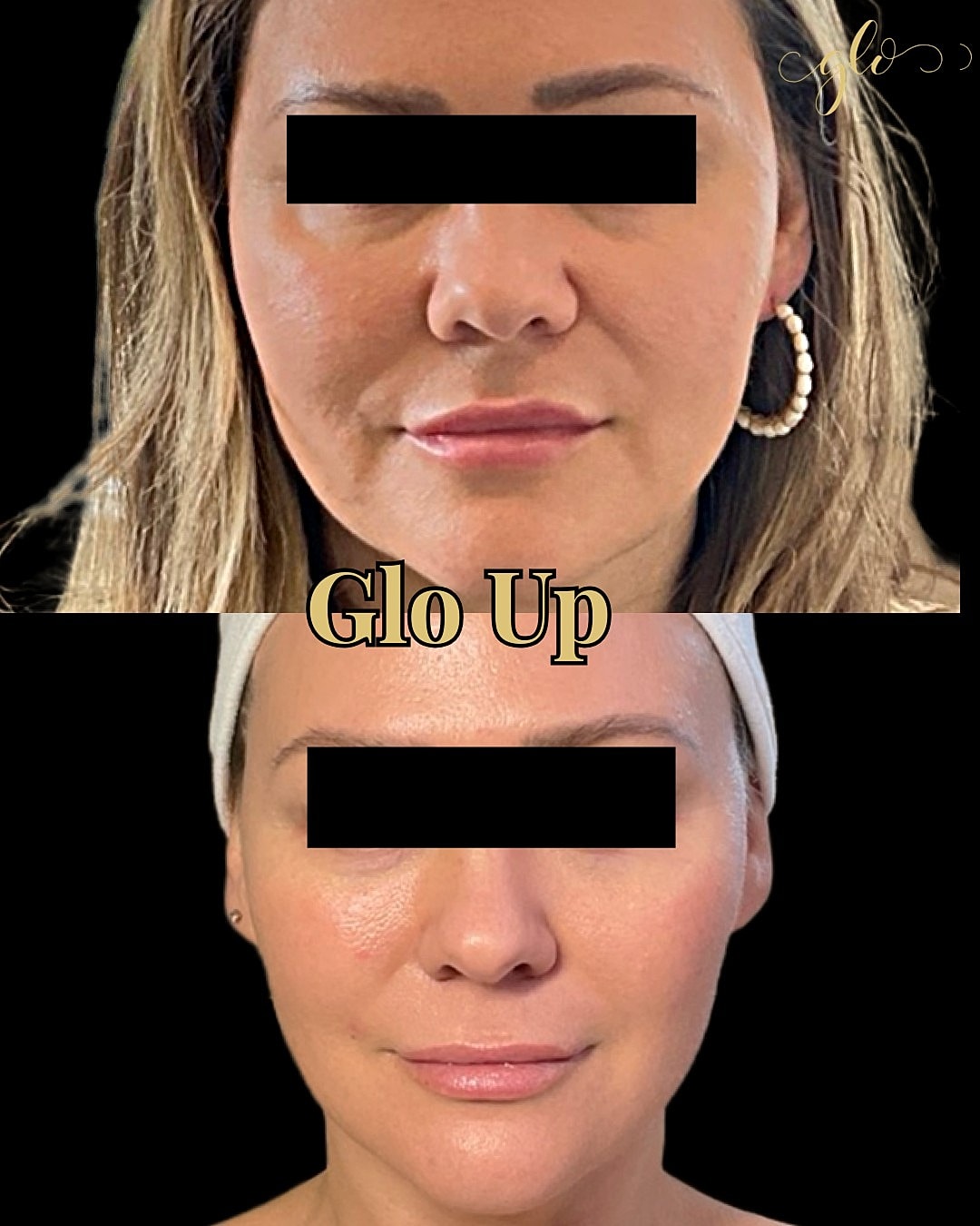 Glo Up Gallery Before & After