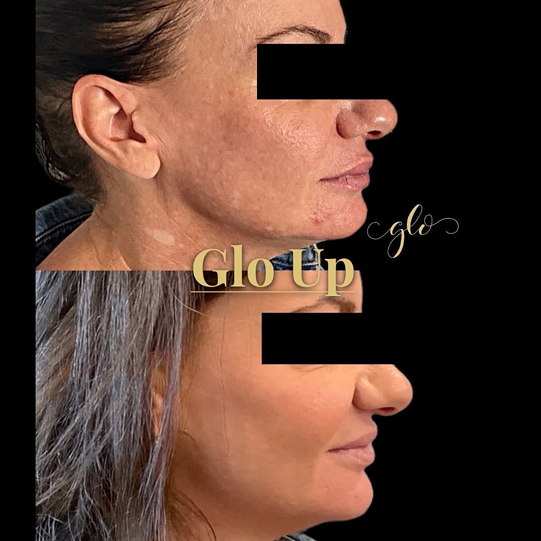 Glo Up Gallery Before & After