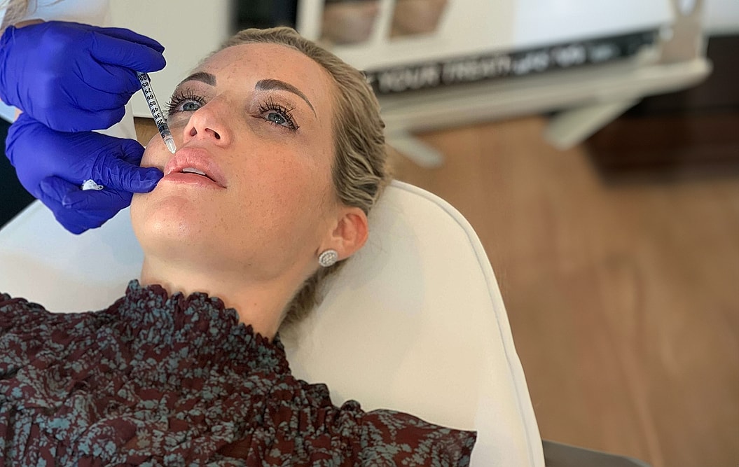 Administering lip filler in a cosmetic procedure.