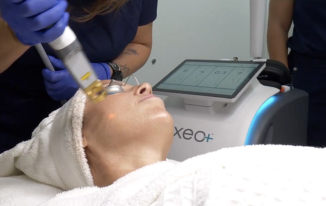 Skincare treatment using laser technology on client.