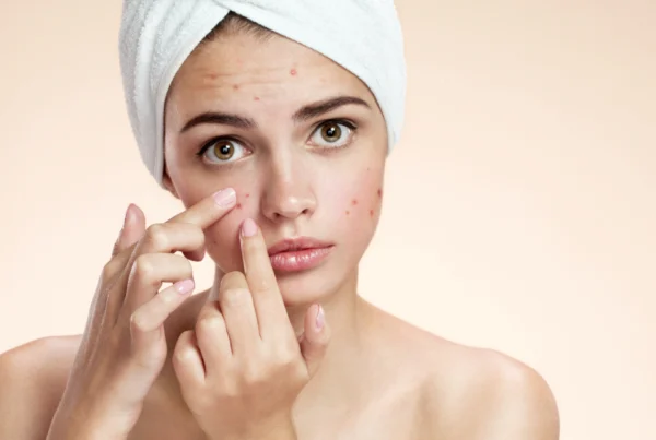 Woman applying ClearGLo Acne System to treat facial breakouts in Far Hills, NJ